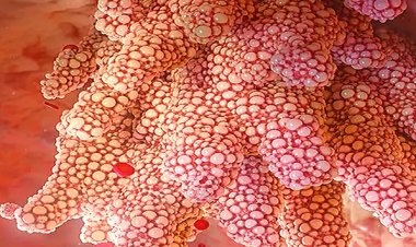 OMS enfatiza a importância da vacinação contra o HPV