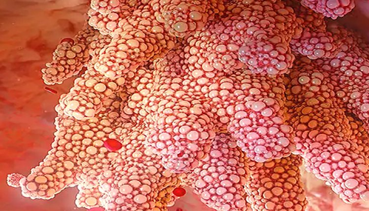 OMS enfatiza a importância da vacinação contra o HPV