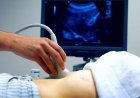 9 exames que podem ajudar a mulher a avaliar a fertilidade antes de engravidar